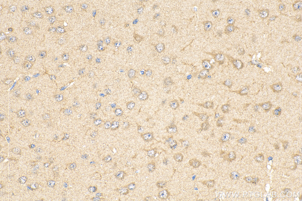 IHC staining of mouse brain using 66113-1-Ig