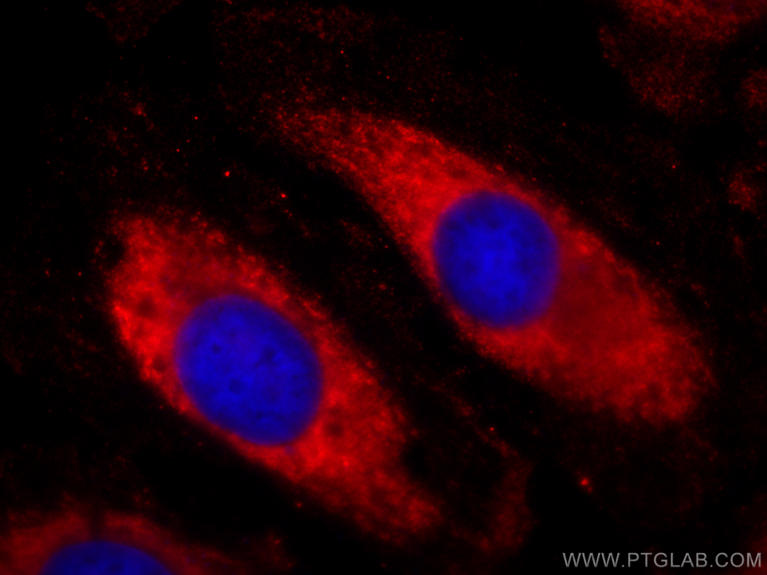 IF Staining of HeLa using CL594-66113