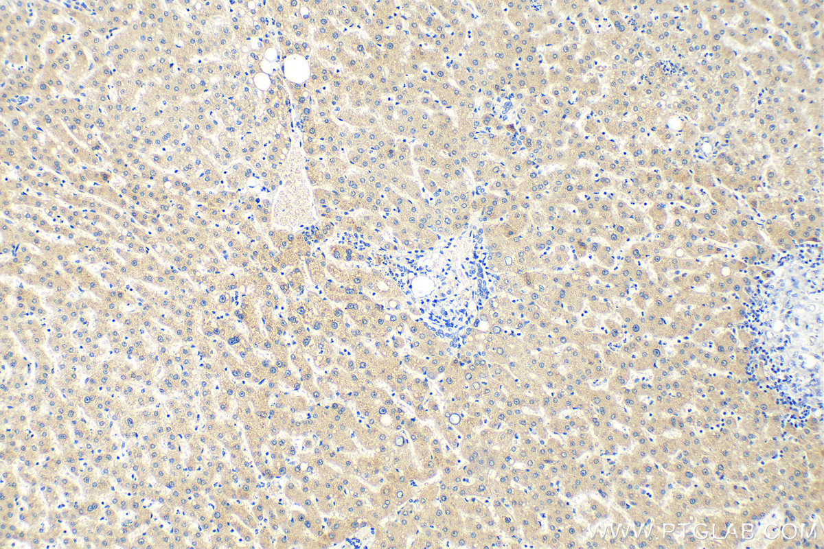 IHC staining of human liver using 82982-6-RR (same clone as 82982-6-PBS)