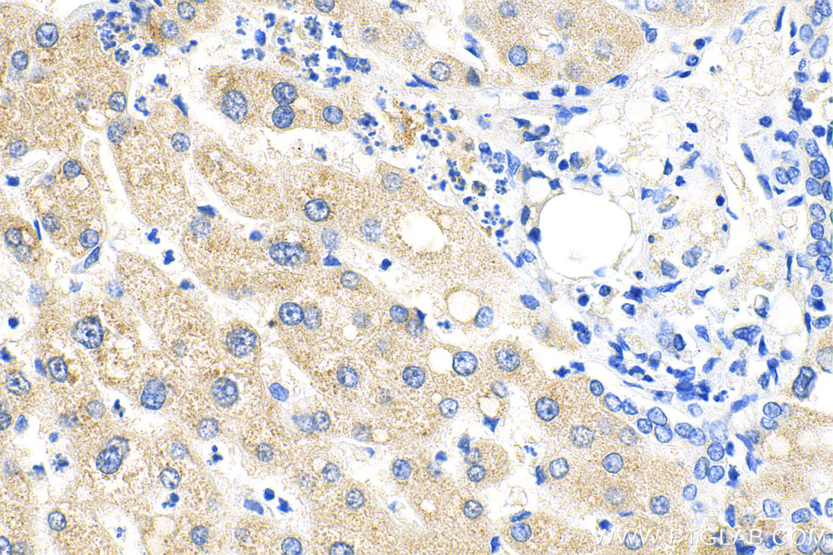 IHC staining of human liver using 82982-6-RR (same clone as 82982-6-PBS)