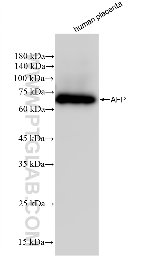 WB analysis of human placenta using 82982-6-RR (same clone as 82982-6-PBS)