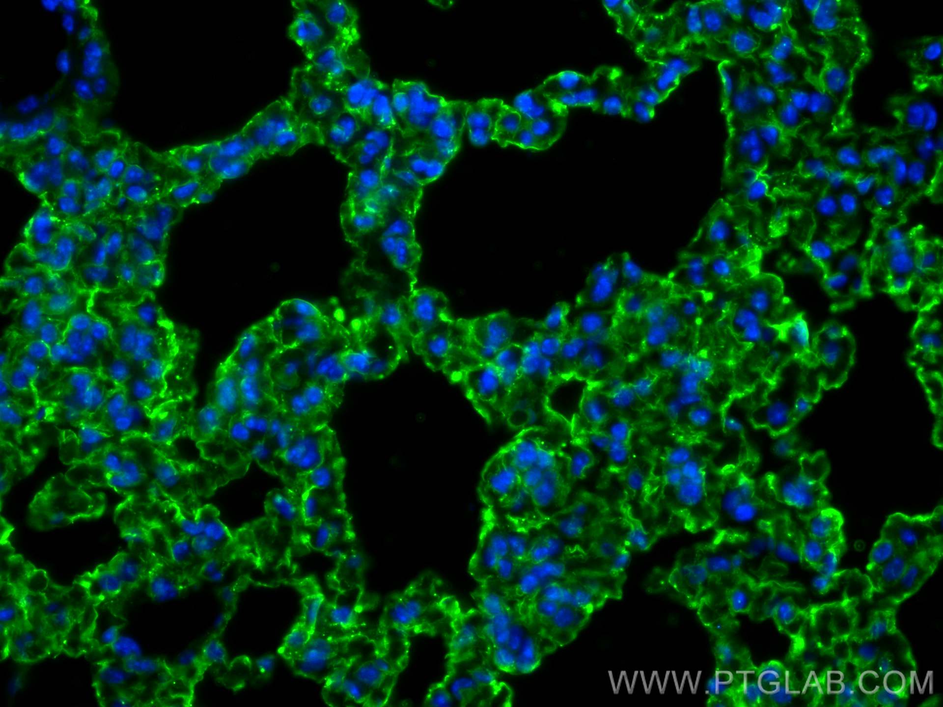 IF Staining of mouse lung using 16346-1-AP