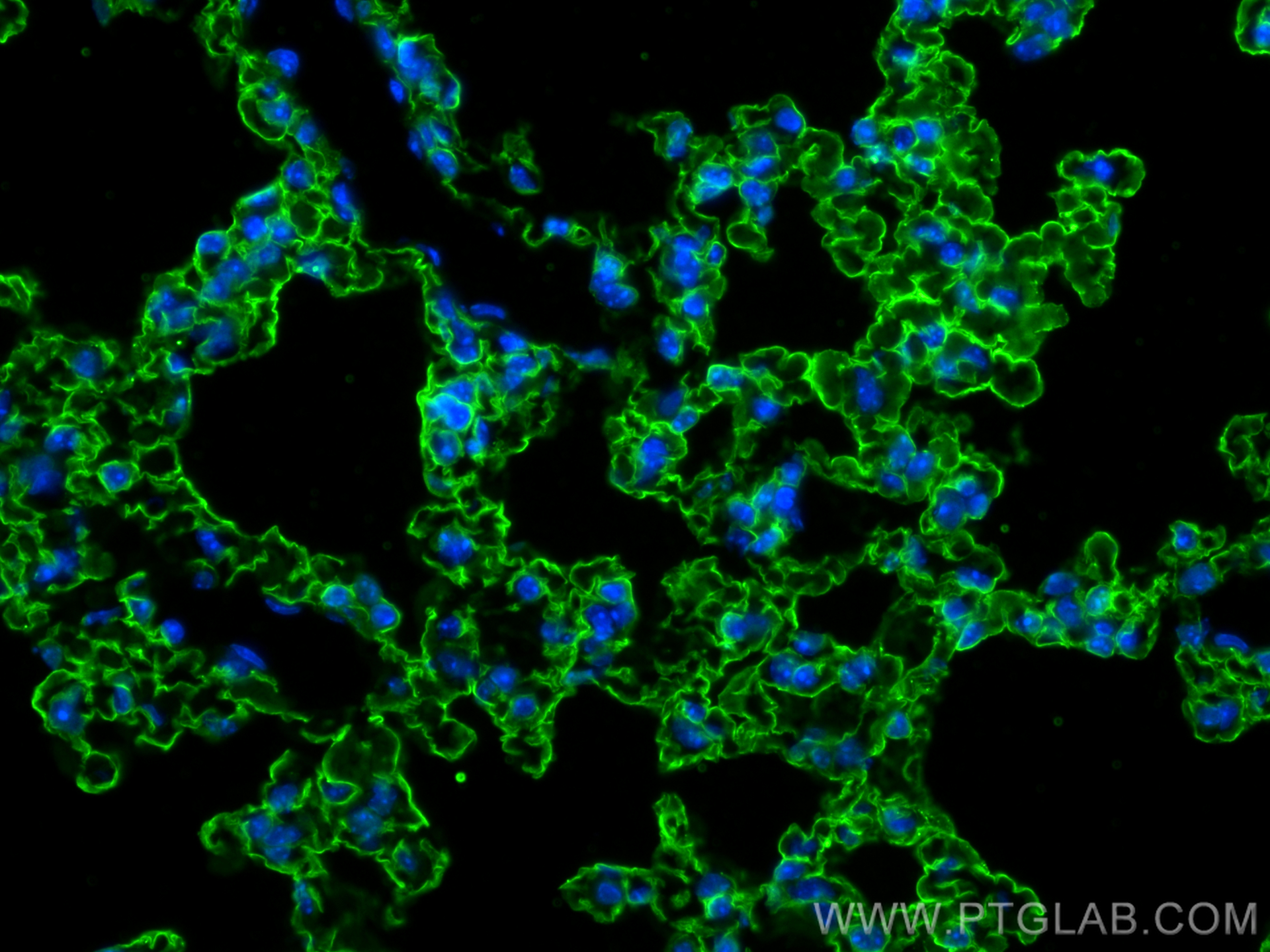 IF Staining of mouse lung using 66833-1-Ig (same clone as 66833-1-PBS)