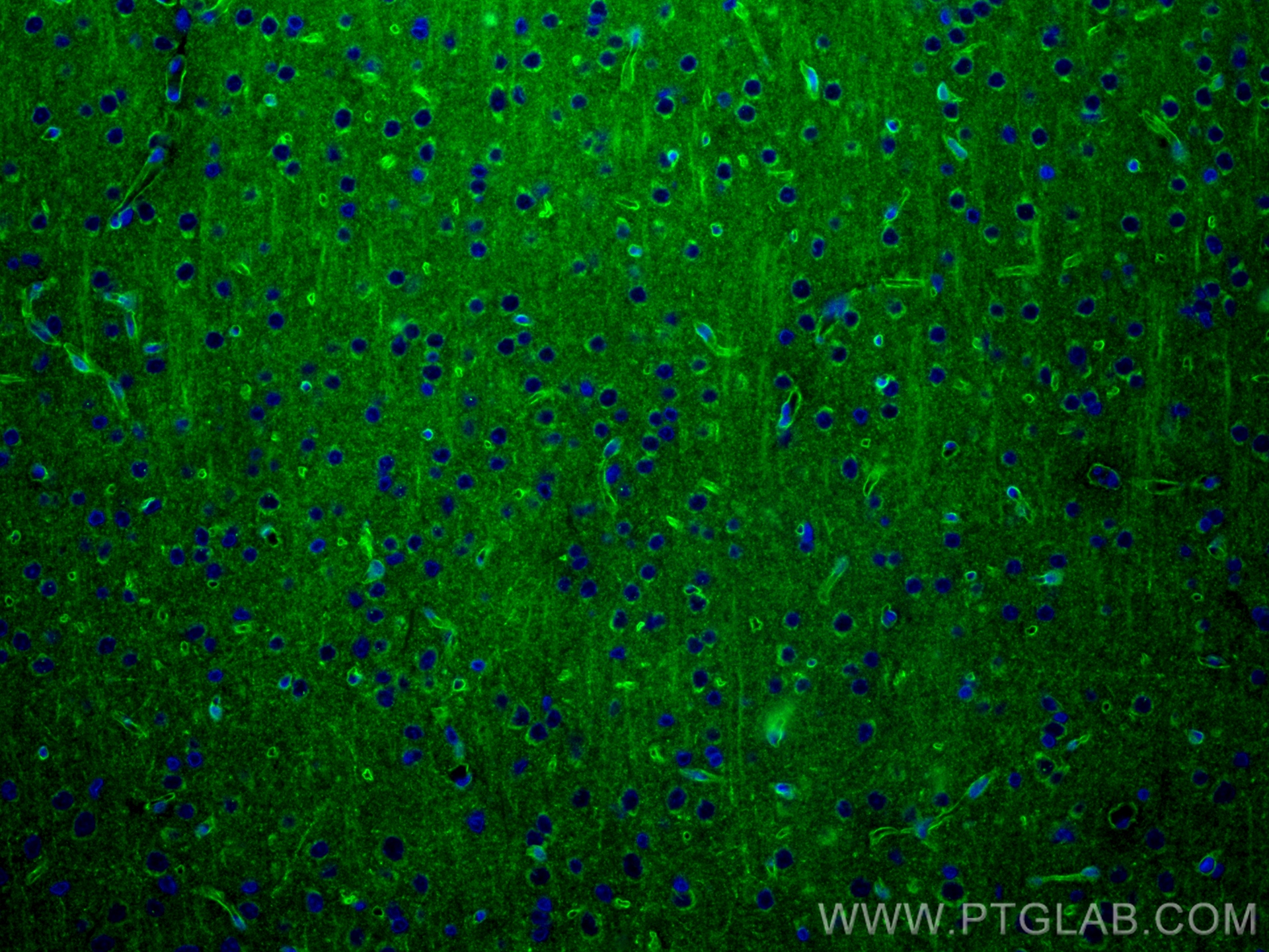 IF Staining of rat brain using 83759-4-RR (same clone as 83759-4-PBS)