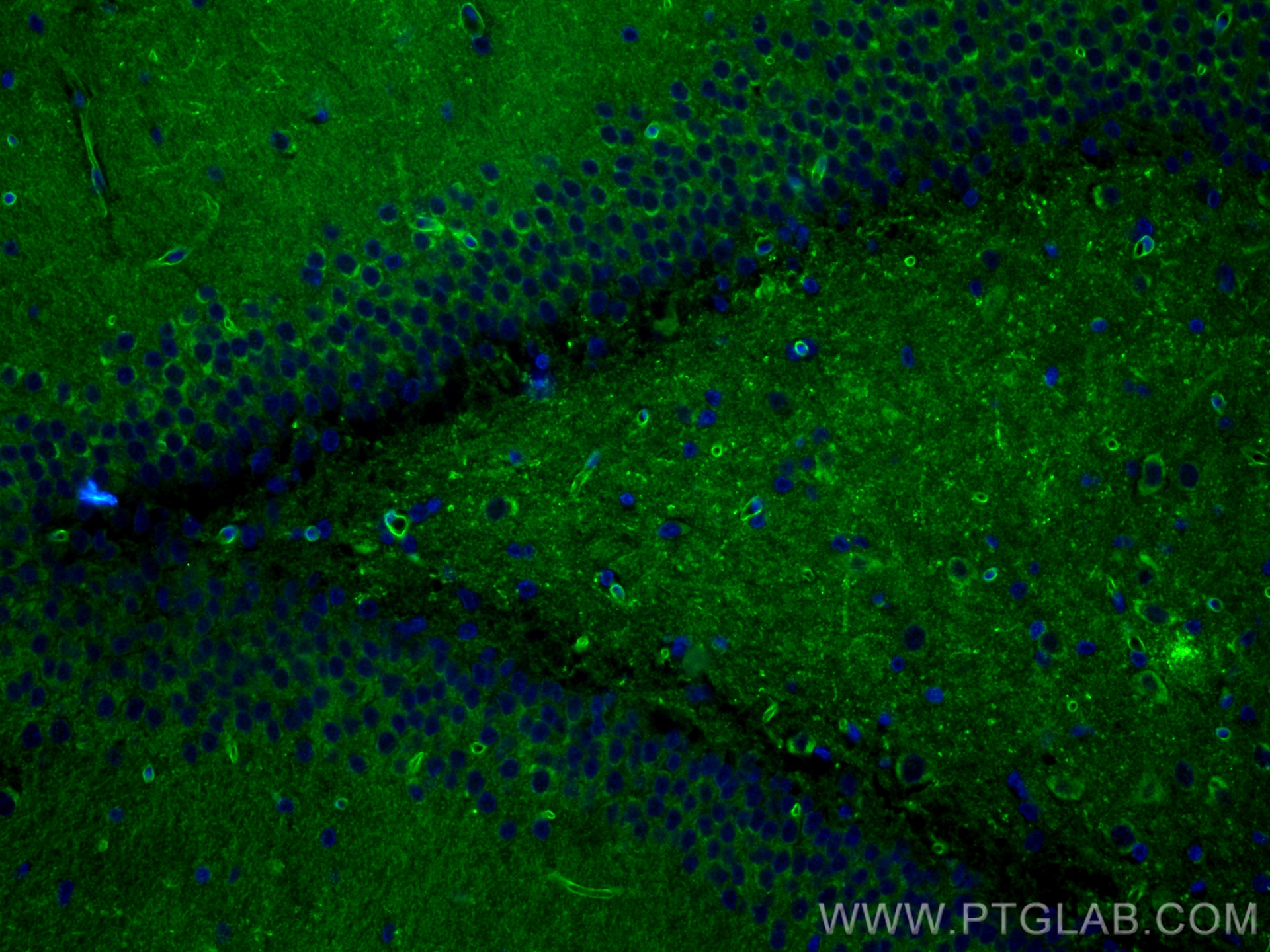 IF Staining of rat brain using 83759-4-RR (same clone as 83759-4-PBS)