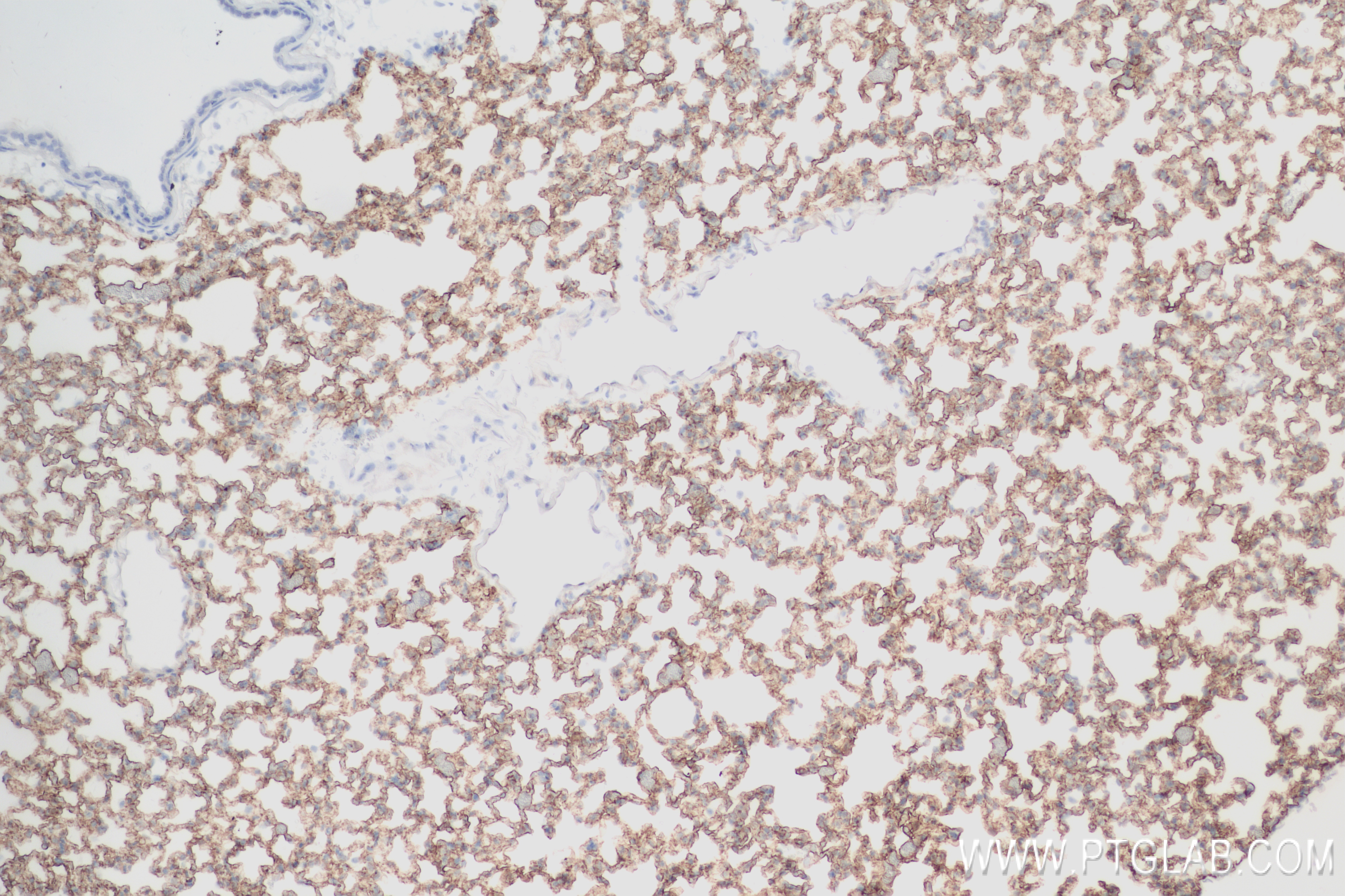 IHC staining of mouse lung using 83759-5-RR (same clone as 83759-5-PBS)