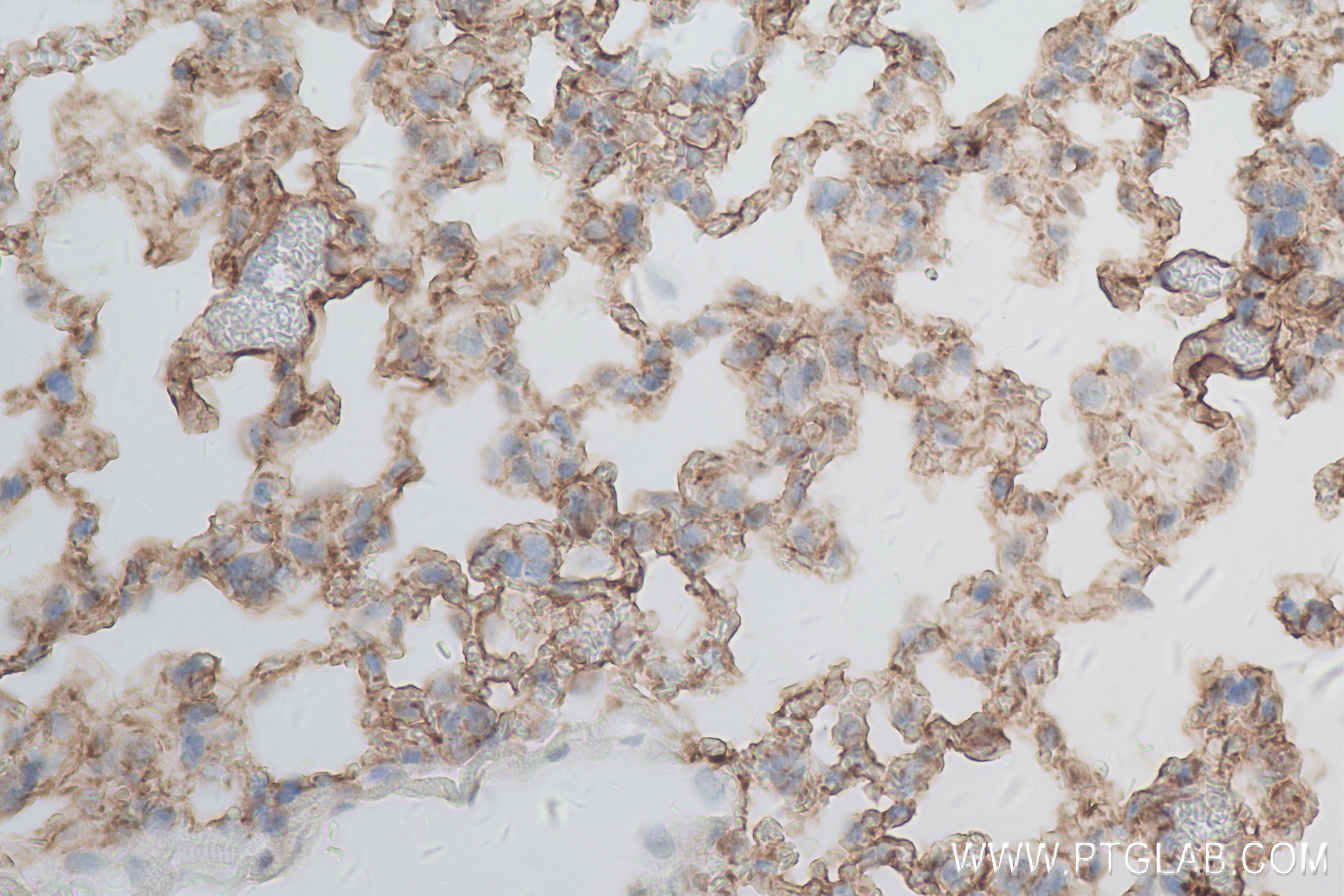 IHC staining of mouse lung using 83759-5-RR (same clone as 83759-5-PBS)