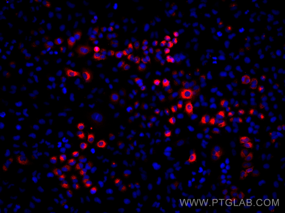 IF Staining of A549 using 66768-1-Ig (same clone as 66768-1-PBS)