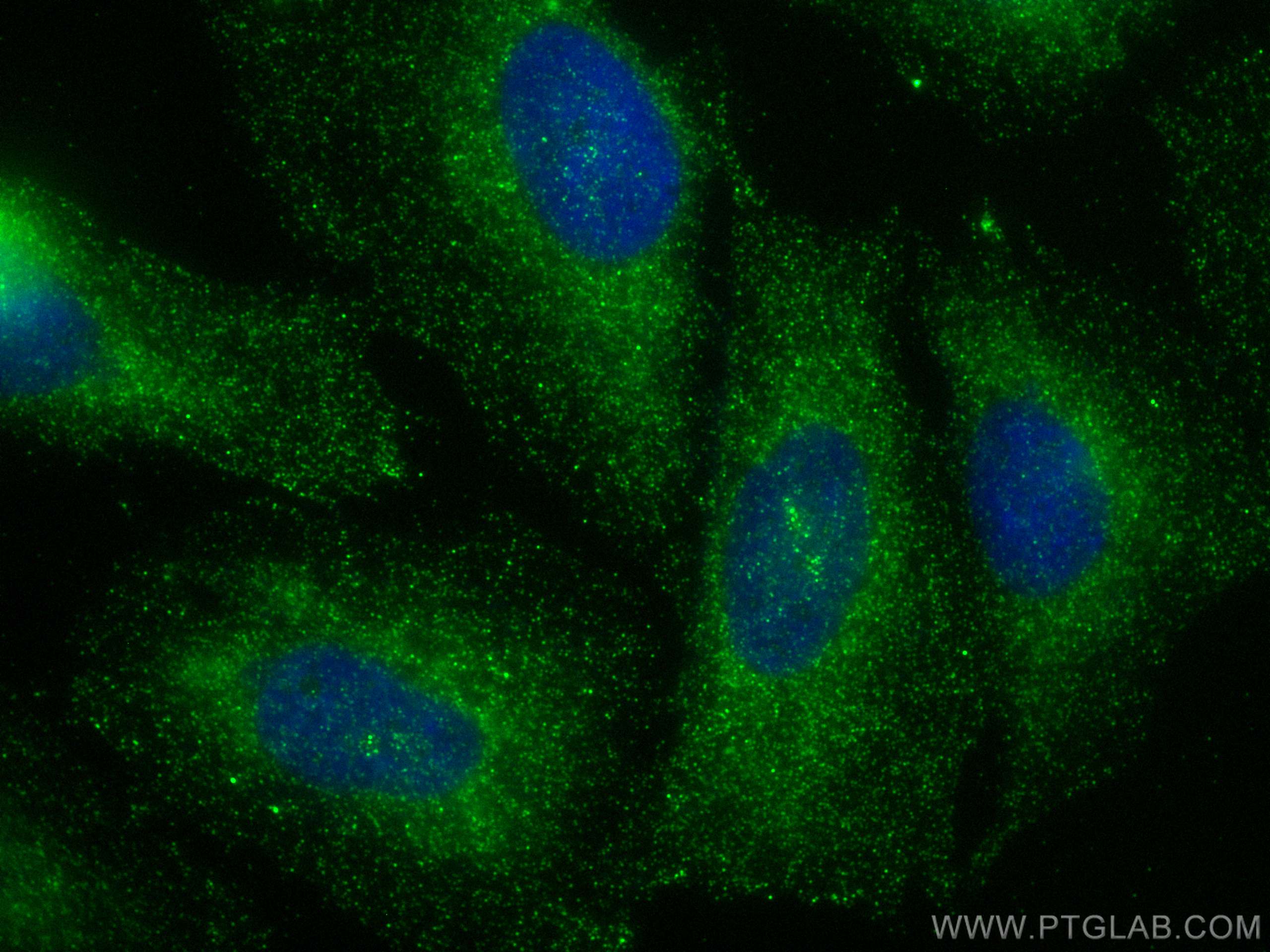 IF Staining of Saos-2 using 20692-1-AP