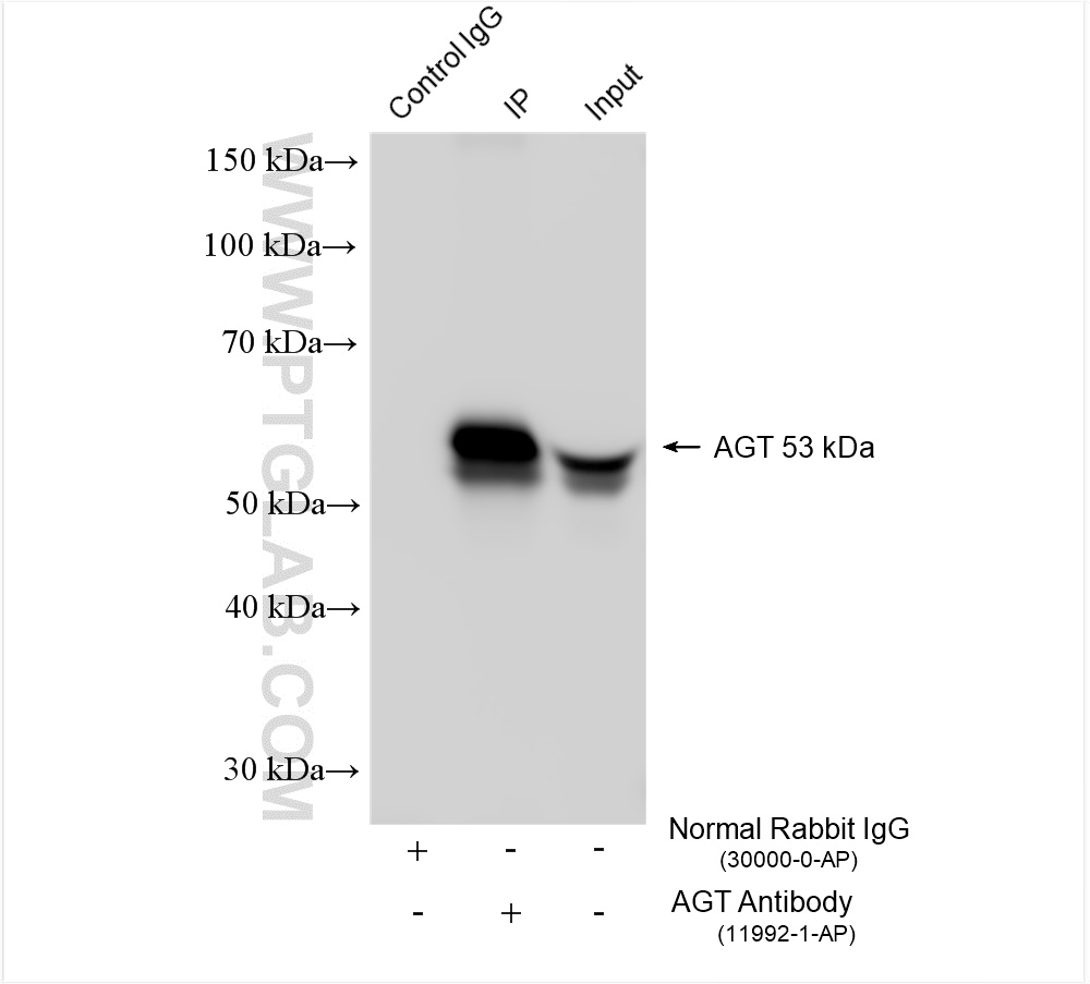 IP experiment of human plasma using 11992-1-AP