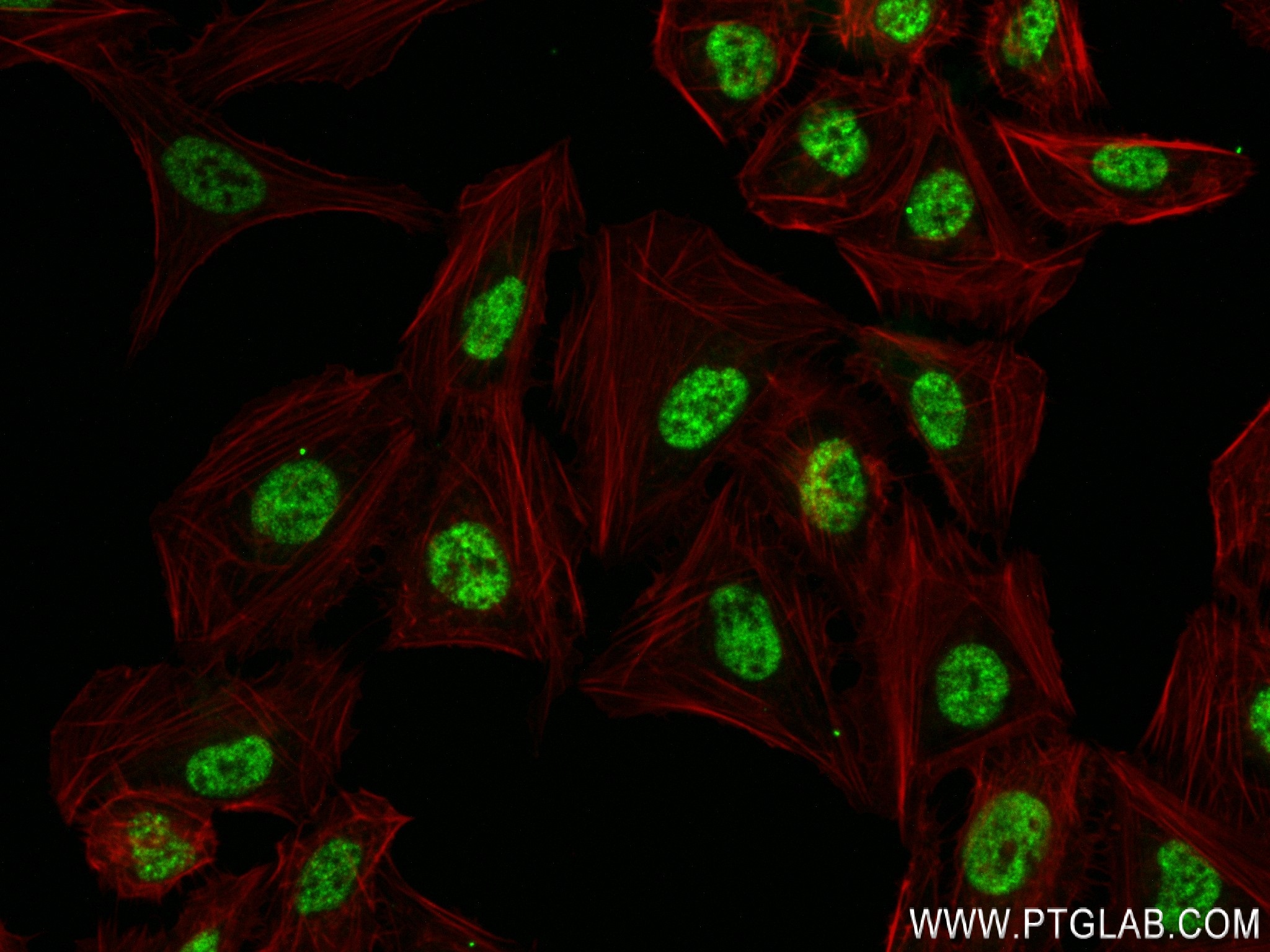 IF Staining of U2OS using 83984-5-RR