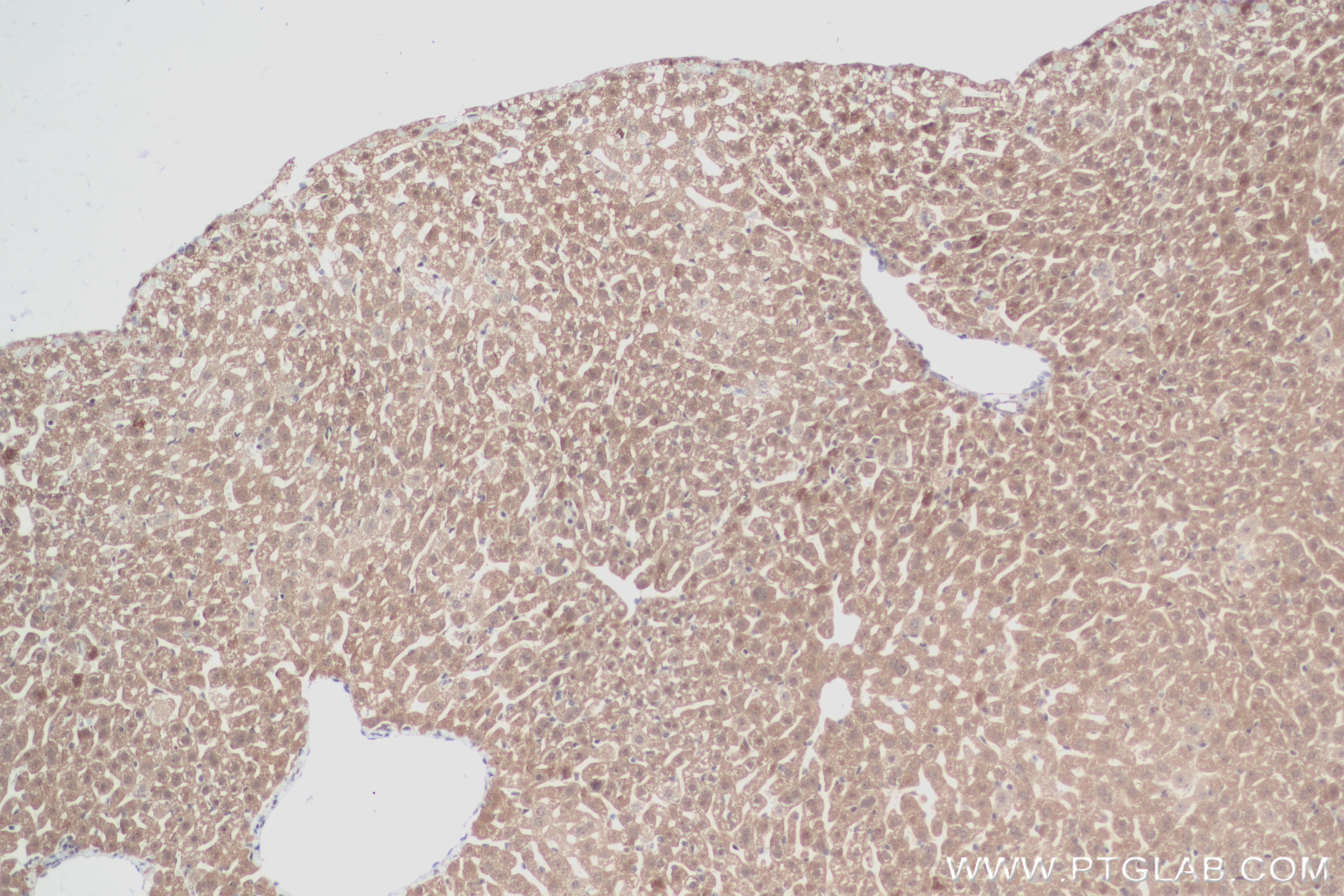 IHC staining of mouse liver using 83984-5-RR