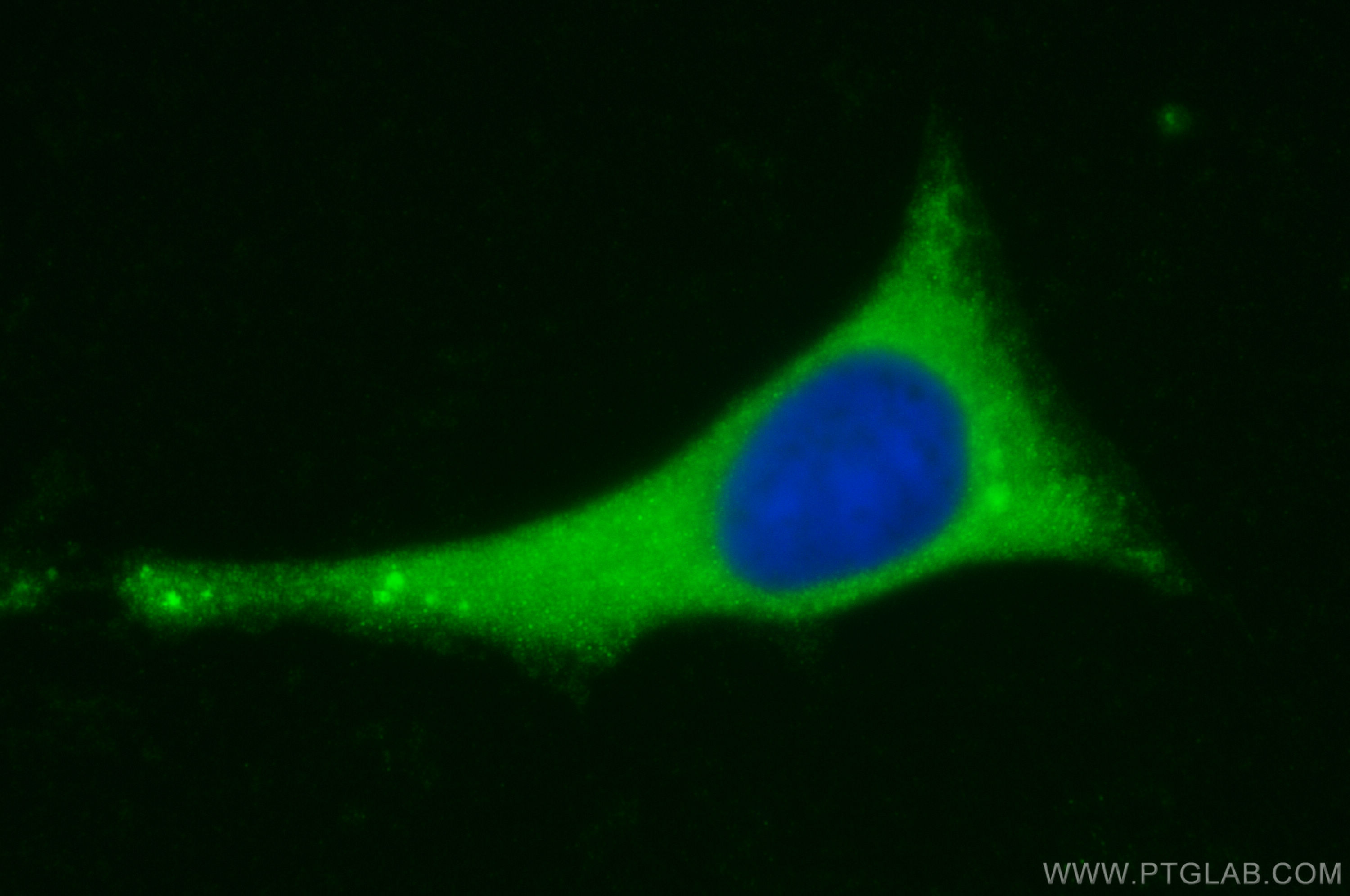 IF Staining of HeLa using 10658-3-AP