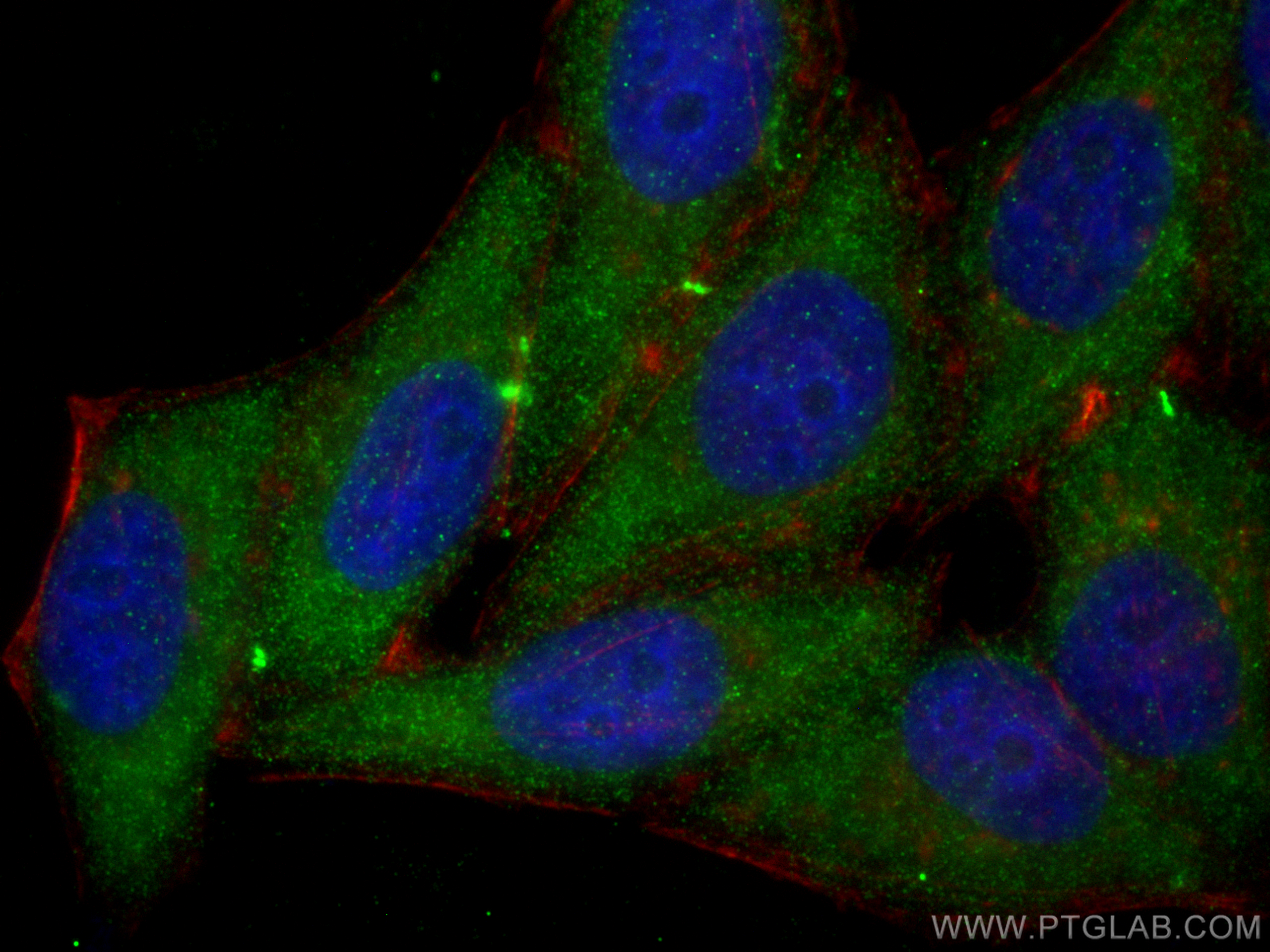 IF Staining of HepG2 using 67785-1-Ig