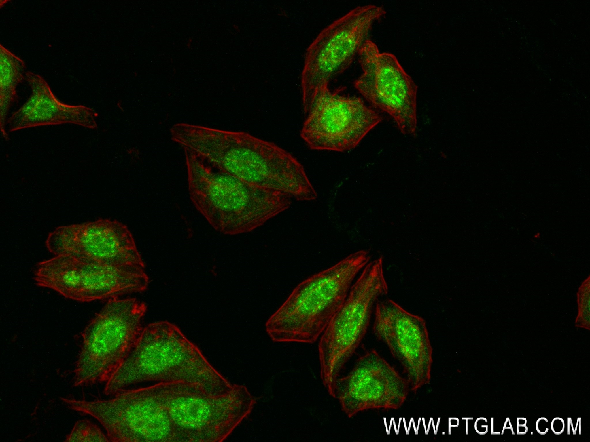 IF Staining of HepG2 using 83369-6-RR (same clone as 83369-6-PBS)