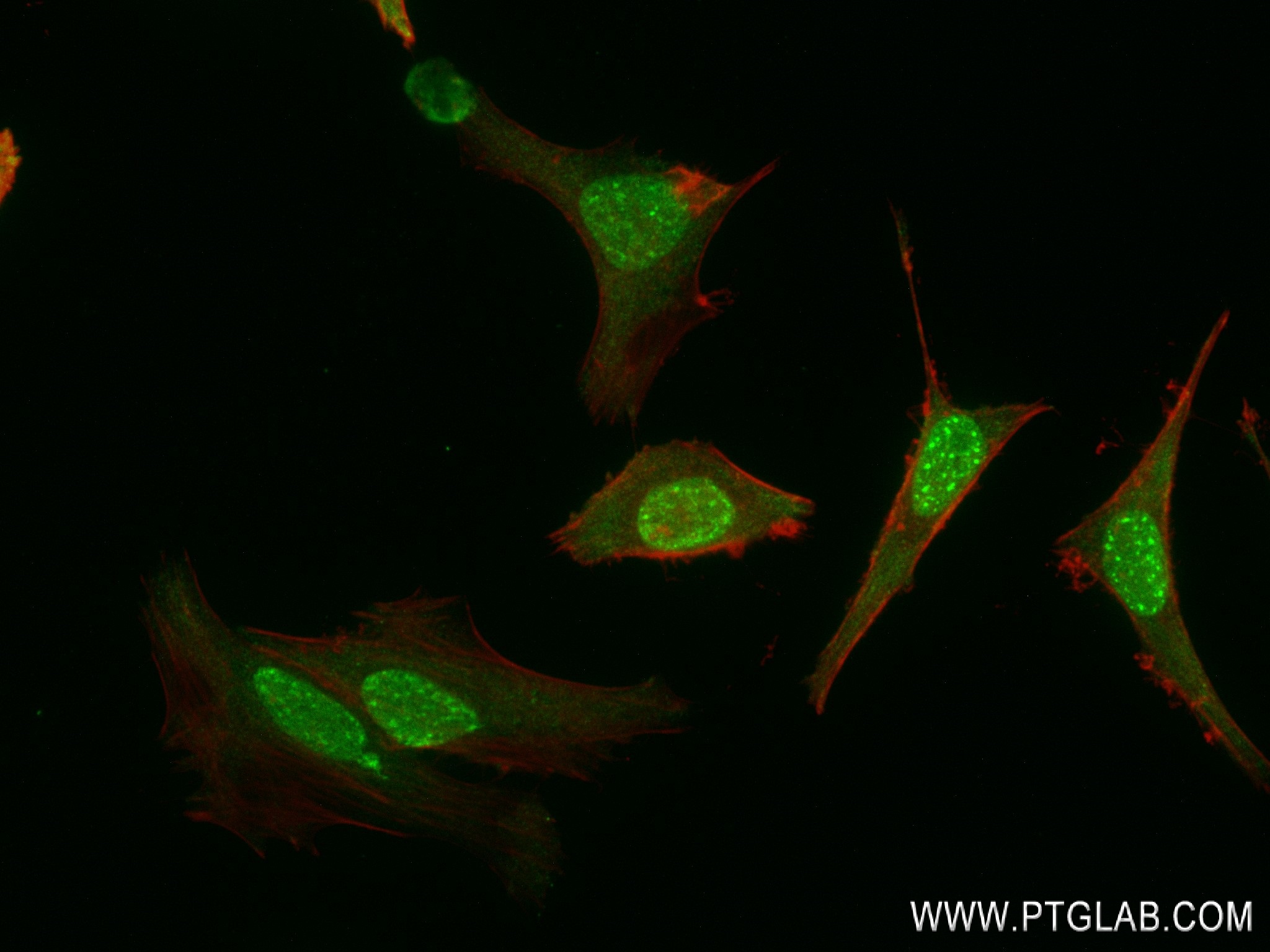 IF Staining of HeLa using 83369-6-RR (same clone as 83369-6-PBS)