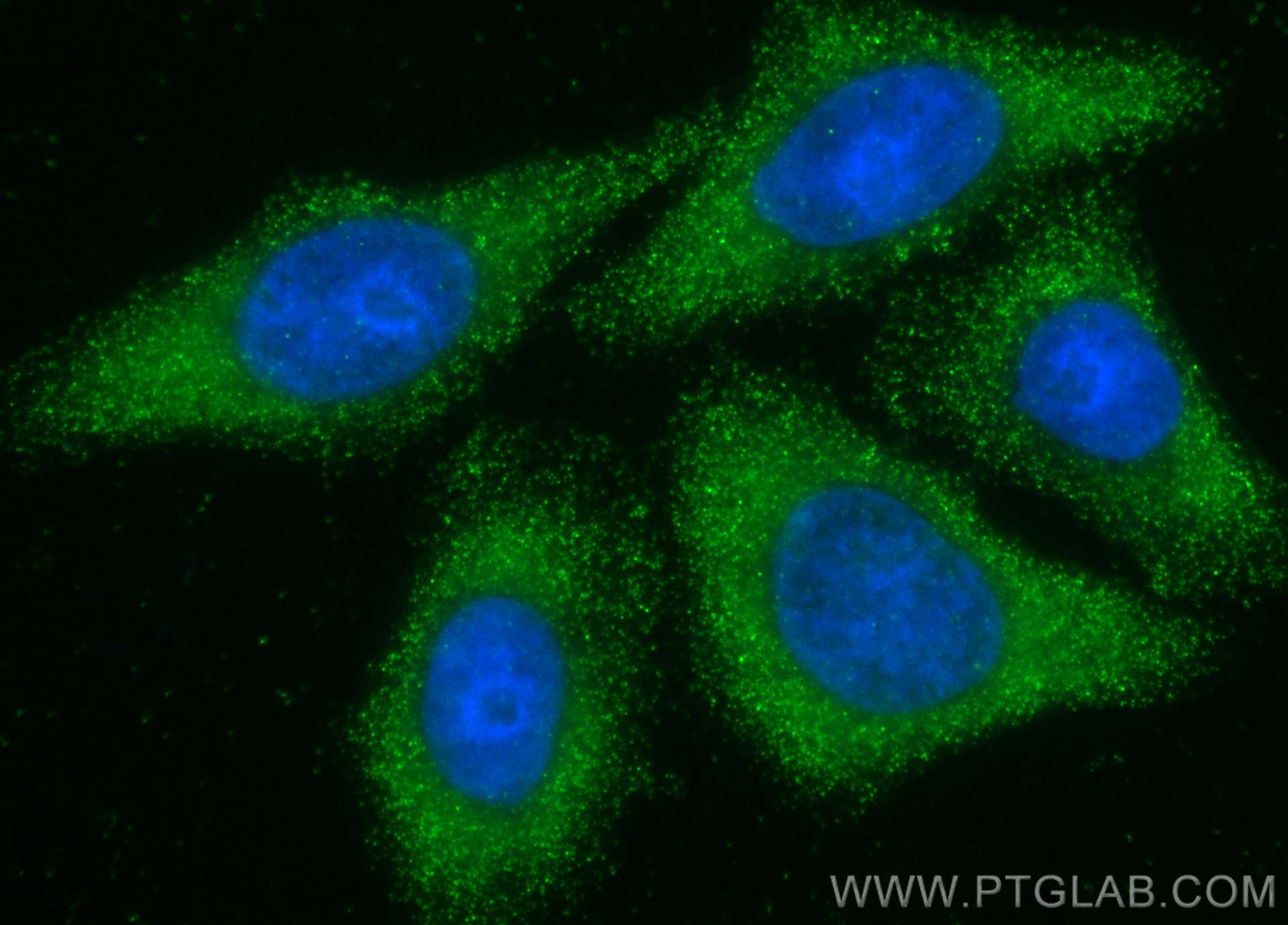 IF Staining of HepG2 using 66094-1-Ig