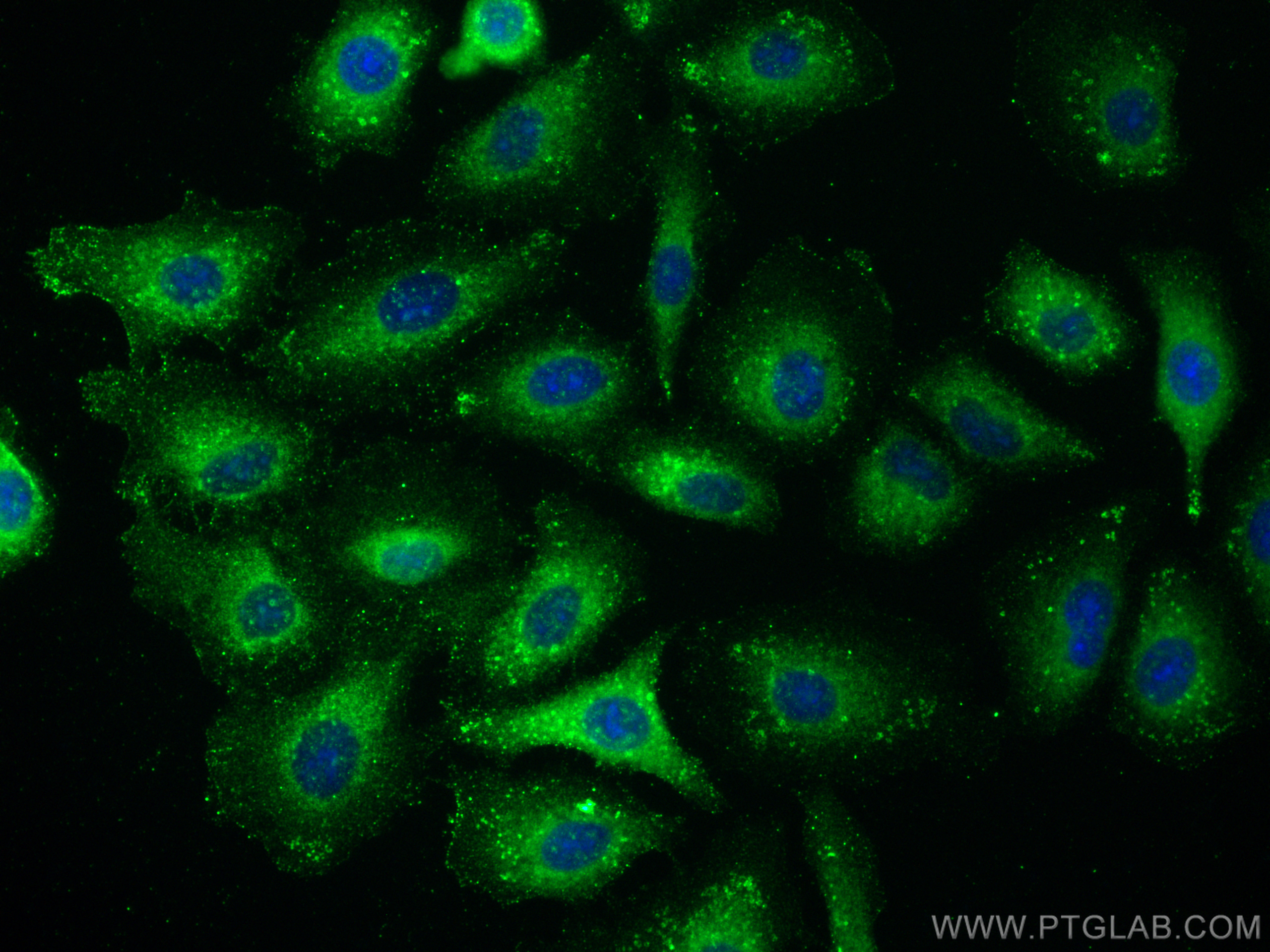 IF Staining of A549 using 20886-1-AP