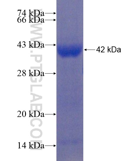 AIM1 fusion protein Ag21872 SDS-PAGE