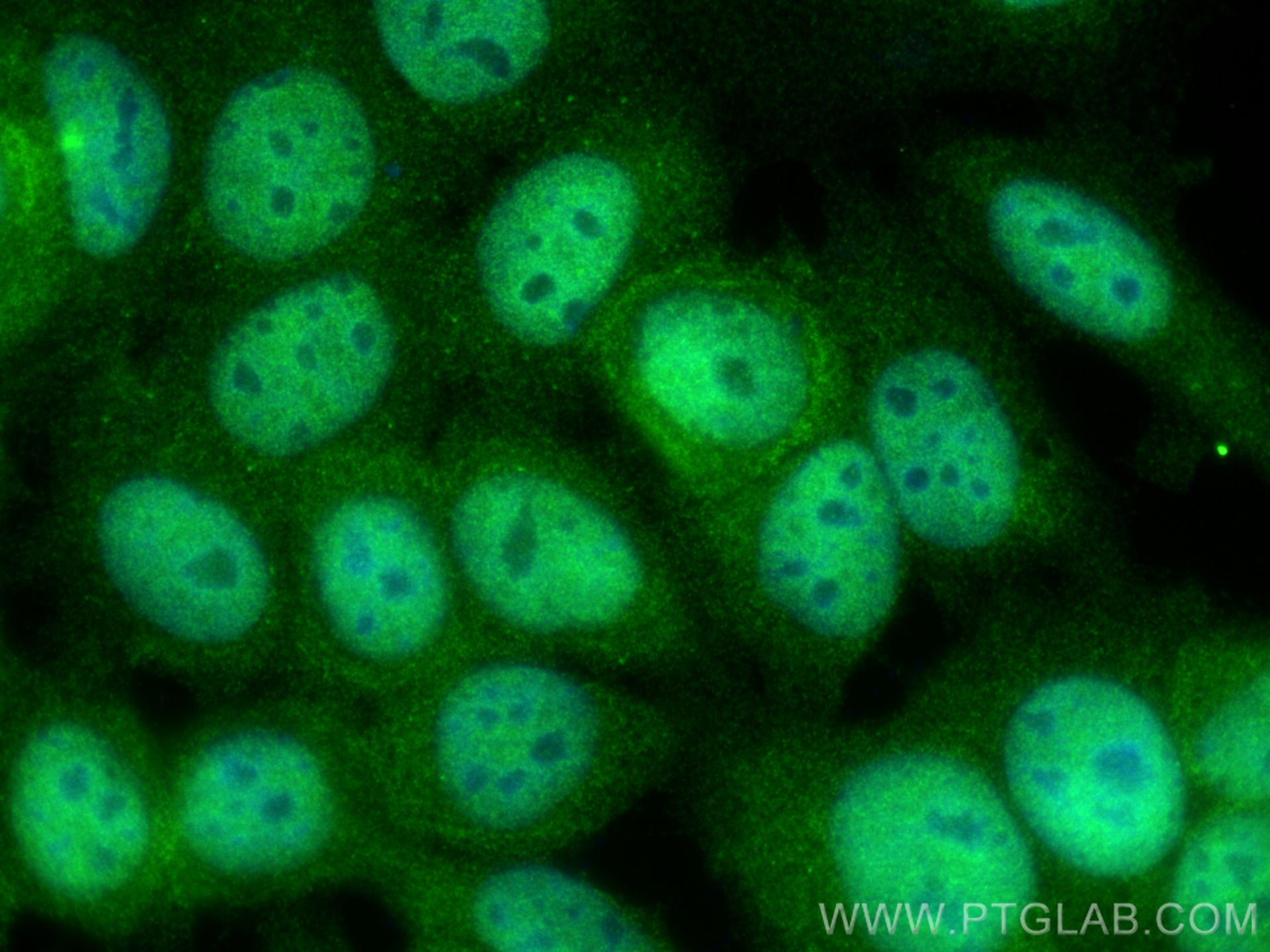 IF Staining of MCF-7 using 20590-1-AP