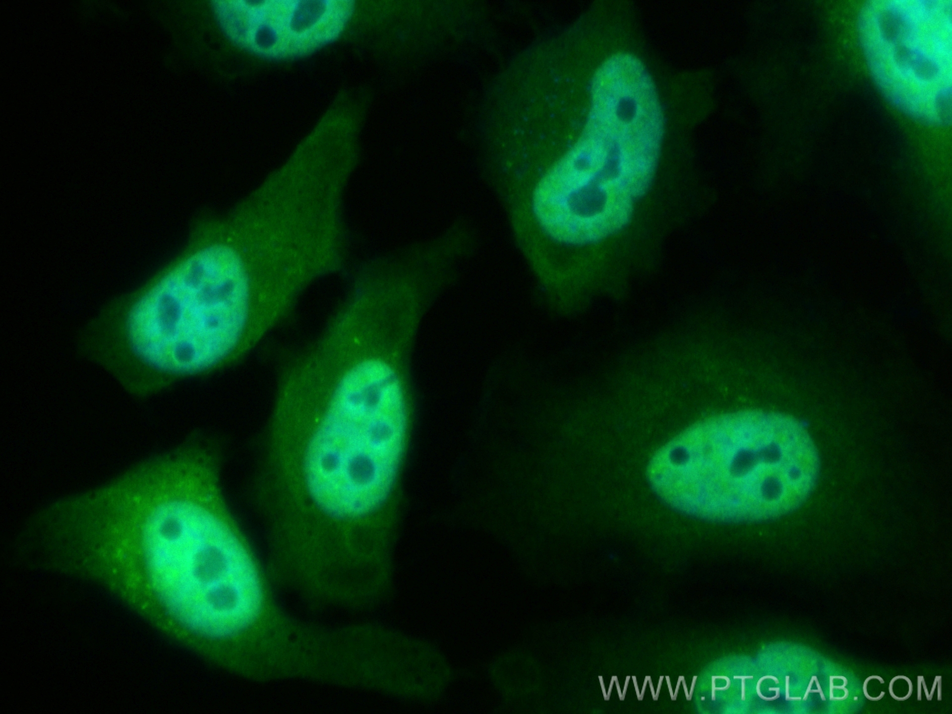 IF Staining of HeLa using CL488-66262