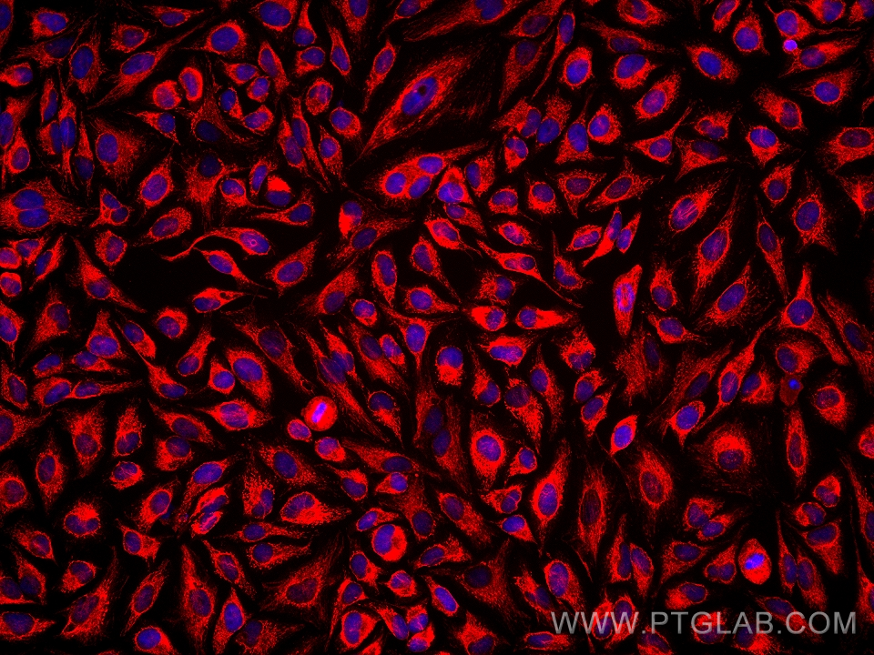 IF Staining of HeLa using 66127-1-Ig (same clone as 66127-1-PBS)