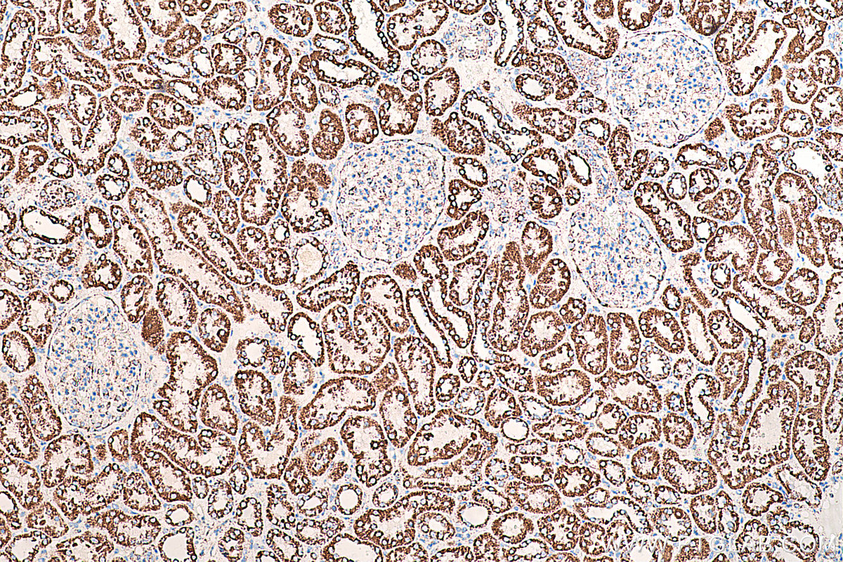 IHC staining of human kidney using 66127-1-Ig (same clone as 66127-1-PBS)