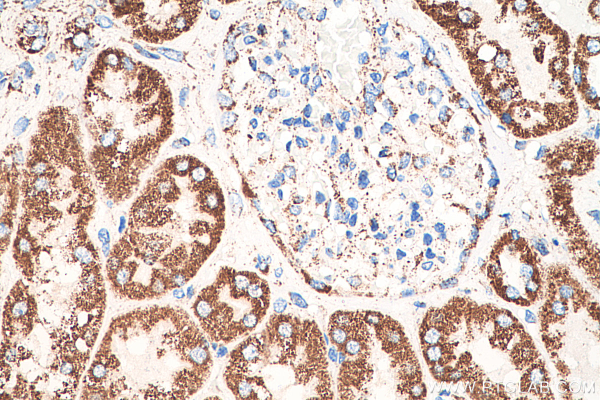 IHC staining of human kidney using 66127-1-Ig (same clone as 66127-1-PBS)