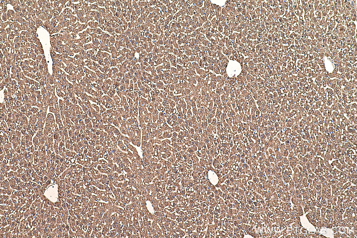 IHC staining of mouse liver using 66127-1-Ig (same clone as 66127-1-PBS)