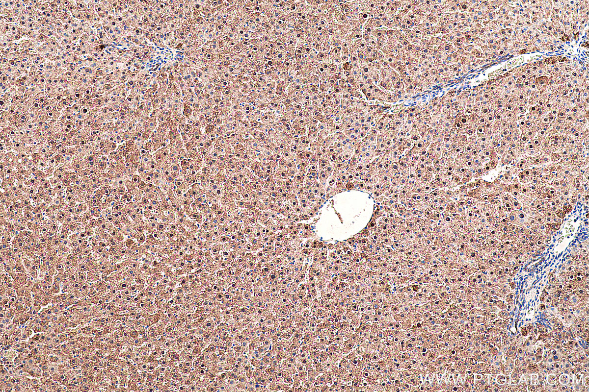 IHC staining of rat liver using 66127-1-Ig (same clone as 66127-1-PBS)