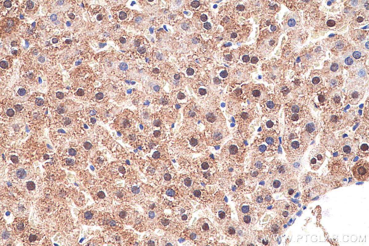 IHC staining of rat liver using 66127-1-Ig (same clone as 66127-1-PBS)