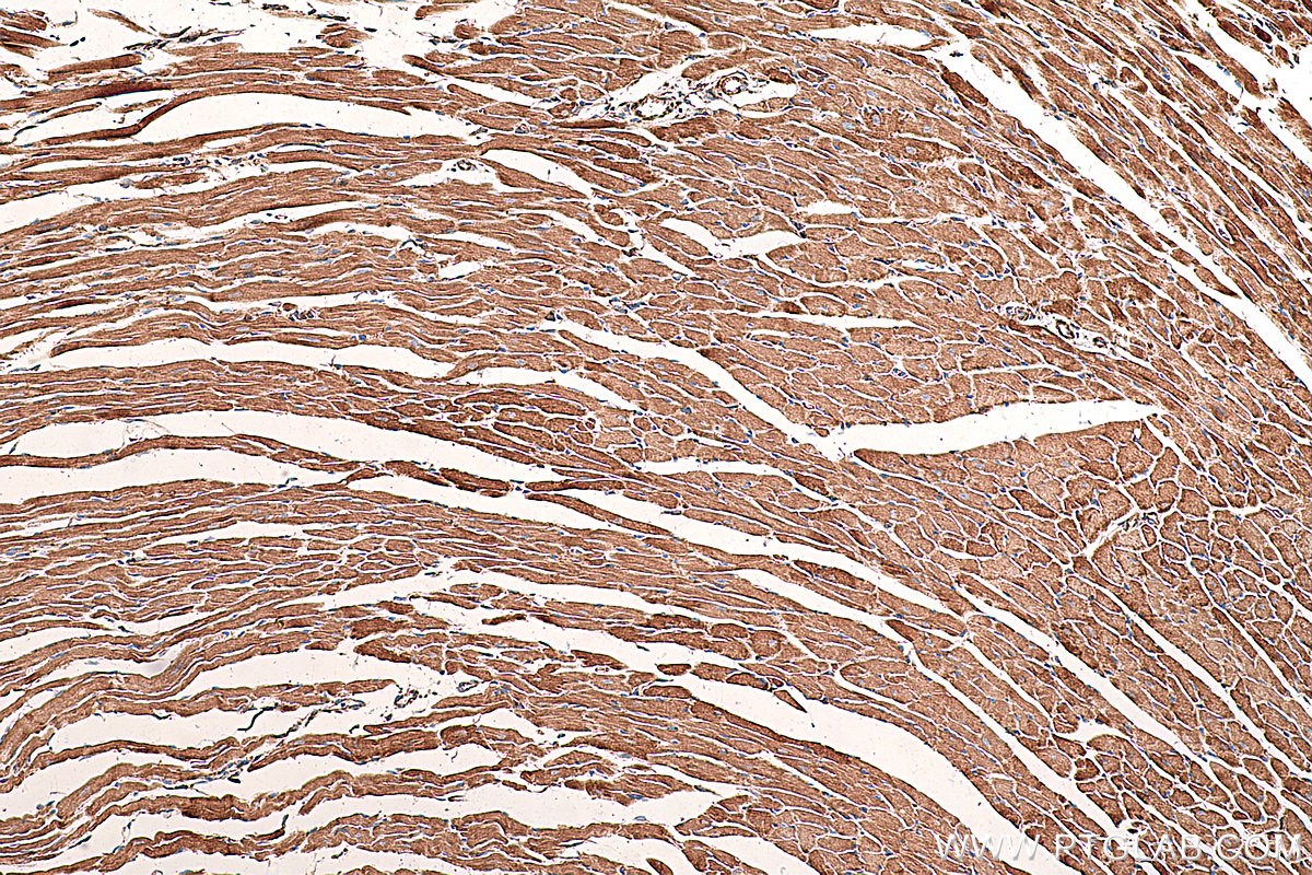 IHC staining of mouse heart using 66127-1-Ig (same clone as 66127-1-PBS)