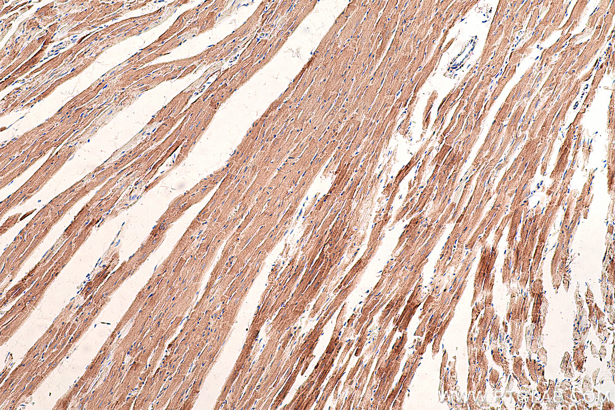 IHC staining of rat heart using 66127-1-Ig (same clone as 66127-1-PBS)