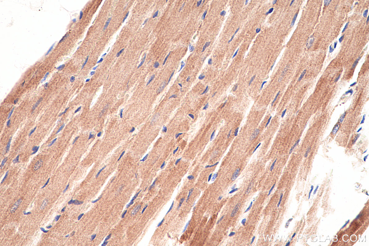 IHC staining of rat heart using 66127-1-Ig (same clone as 66127-1-PBS)