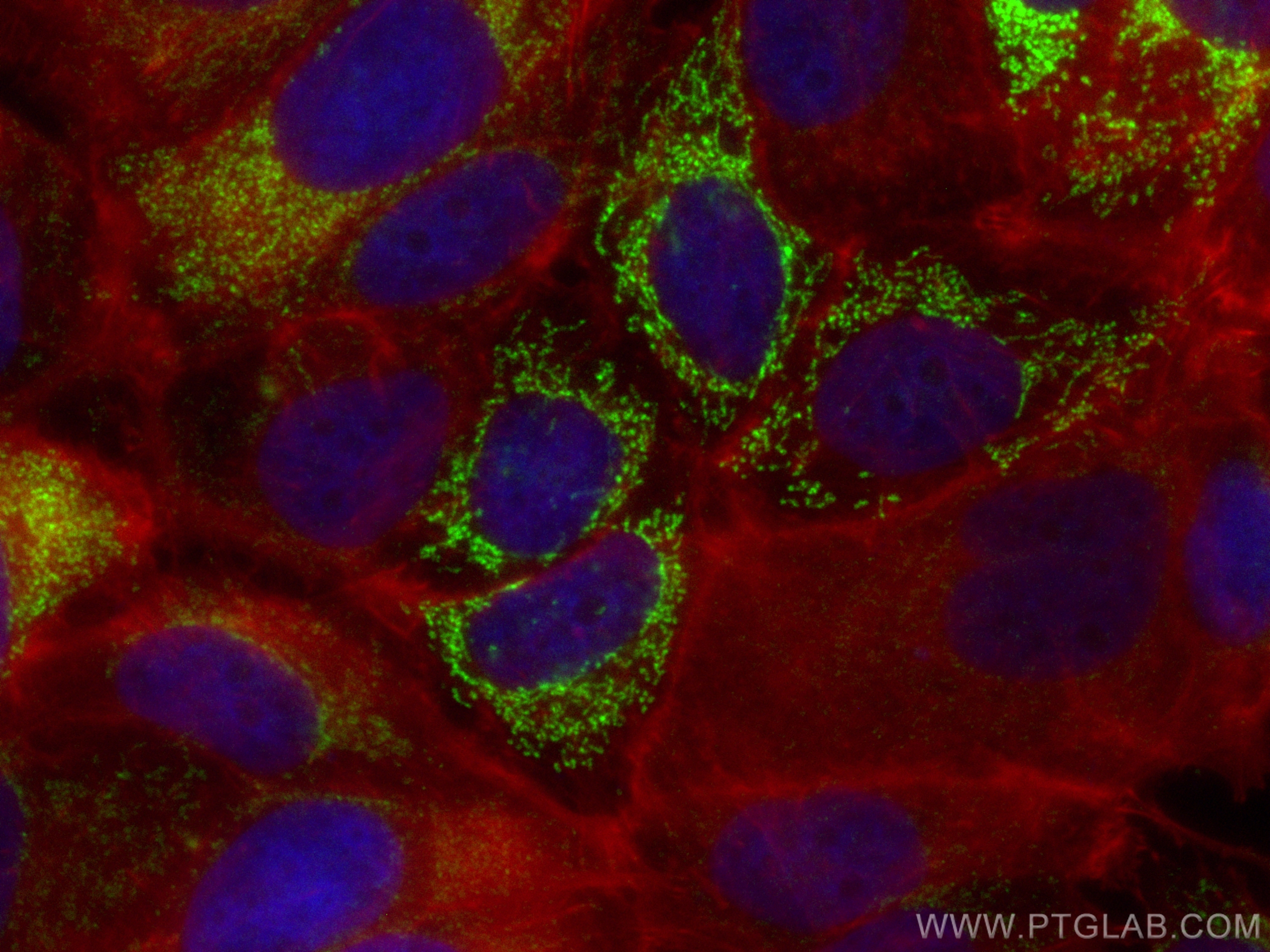 IF Staining of MCF-7 using CL488-13206