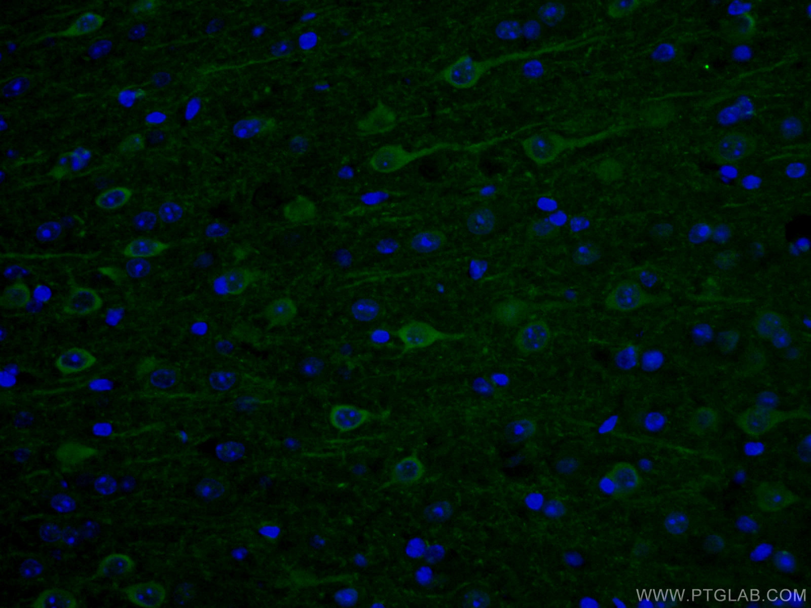 IF Staining of mouse brain using 12510-2-AP