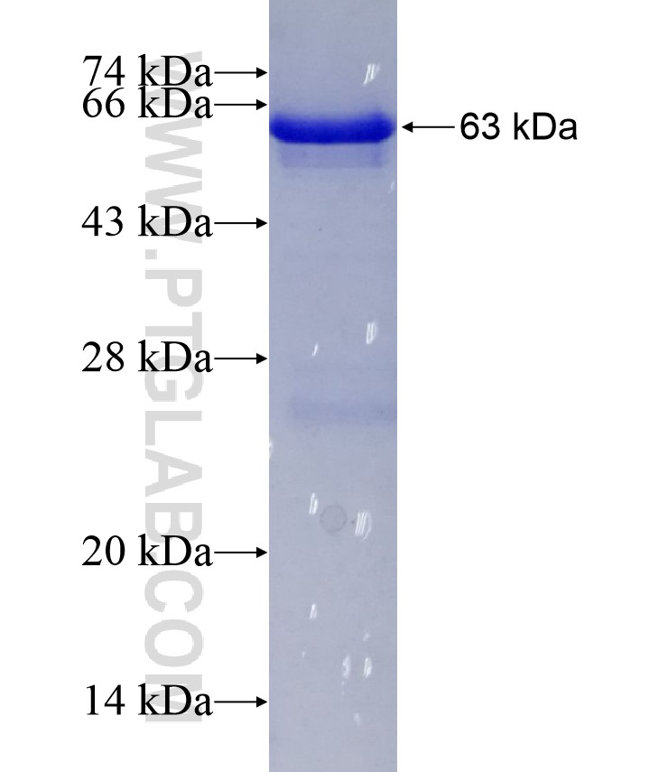 AK5 fusion protein Ag3203 SDS-PAGE