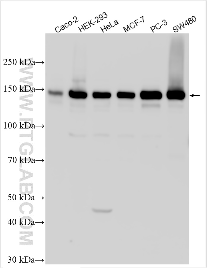 WB analysis using 15618-1-AP