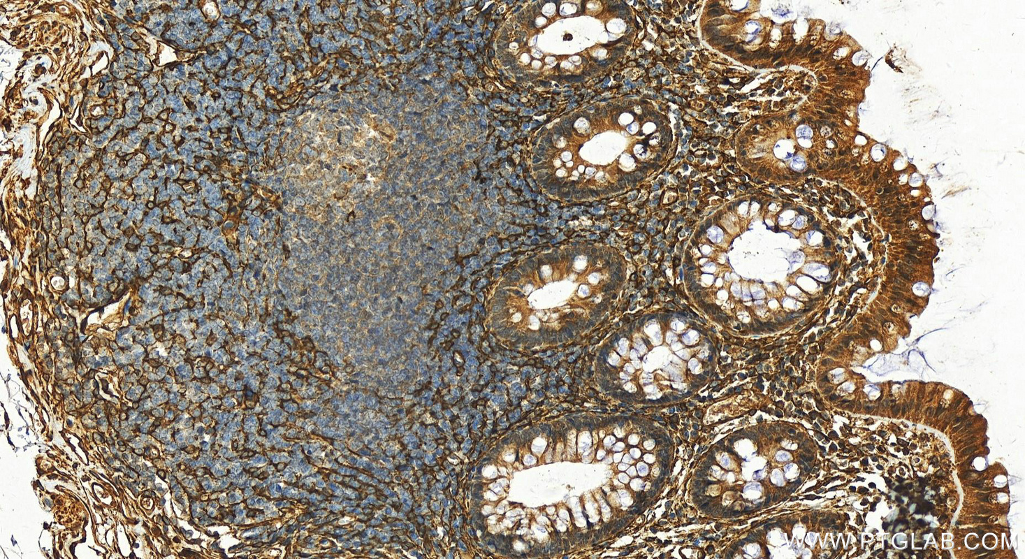 IHC staining of human normal colon using 25199-1-AP