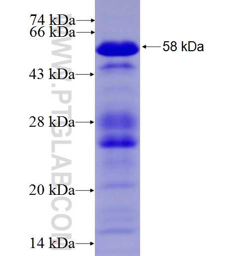 AKAP2 fusion protein Ag25806 SDS-PAGE