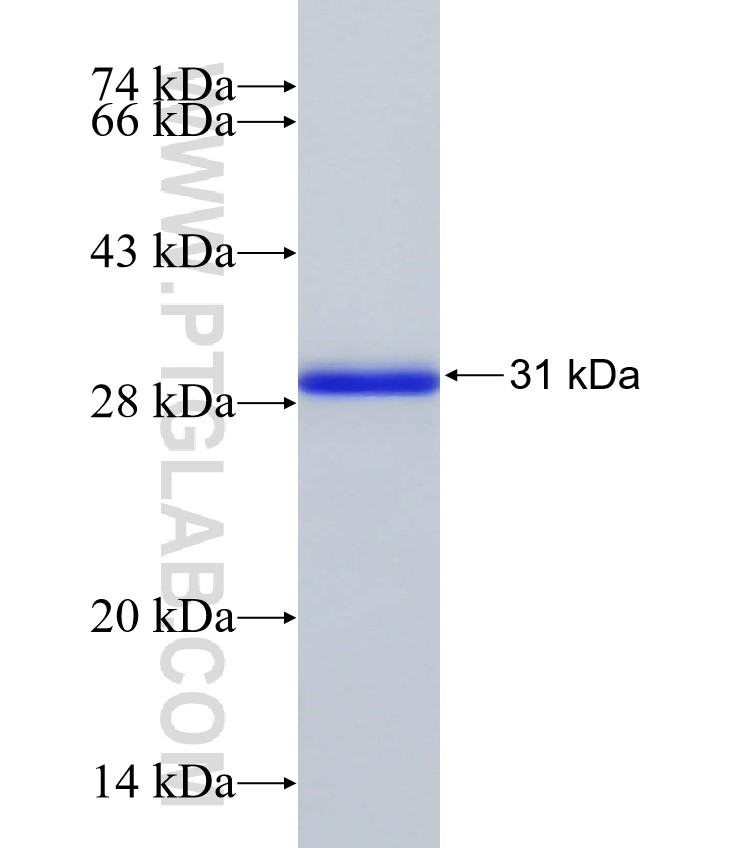 AKAP9 fusion protein Ag32399 SDS-PAGE