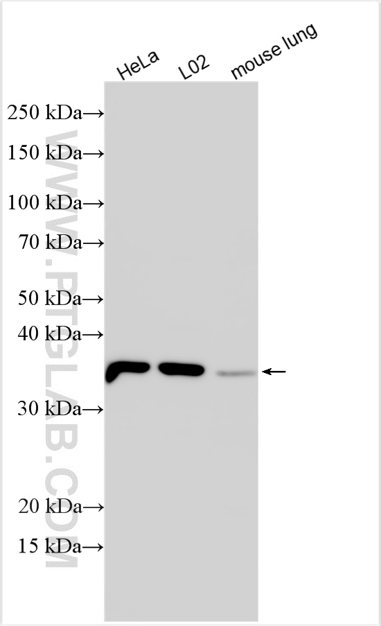 WB analysis using 15054-1-AP