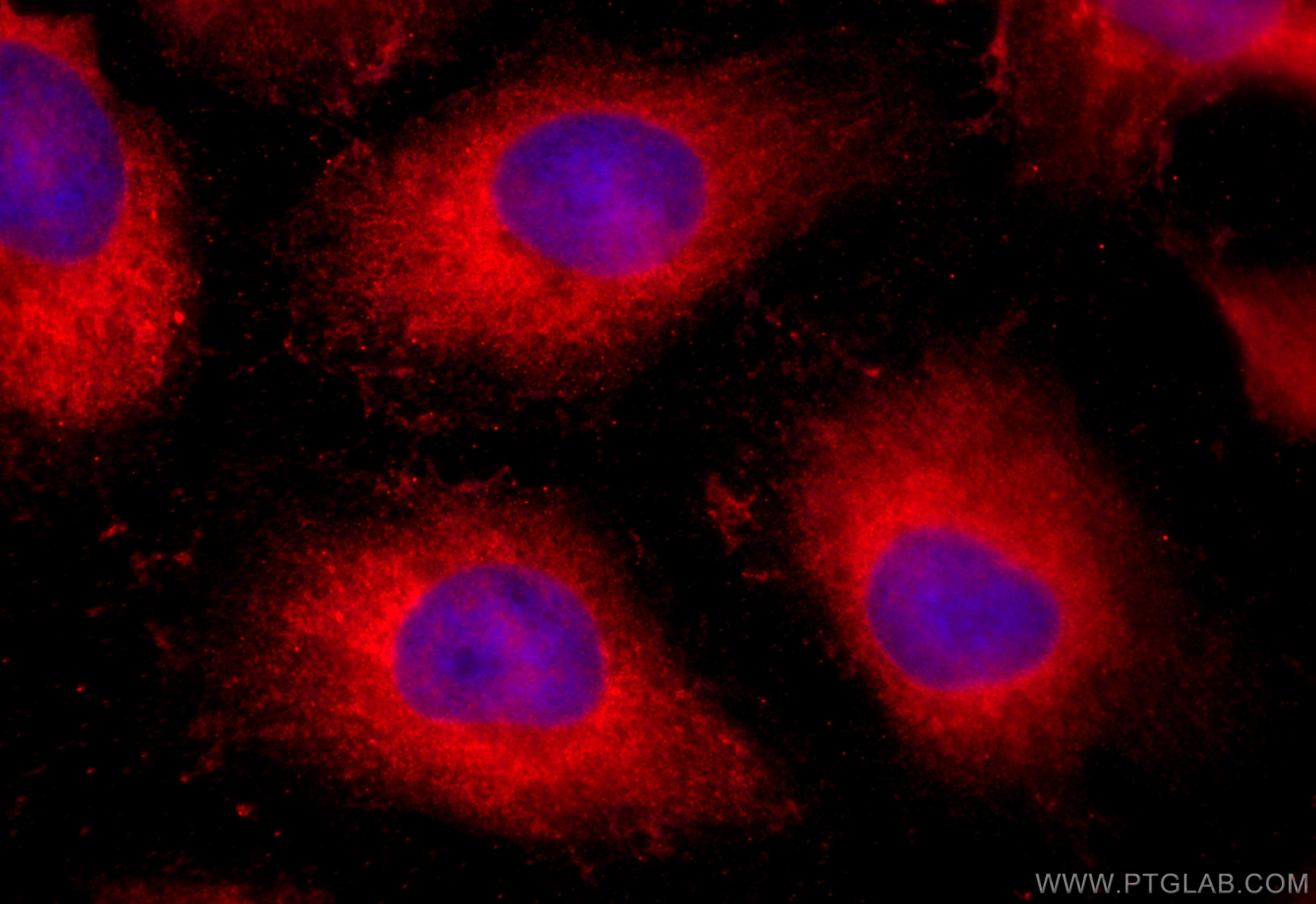 IF Staining of HeLa using 20525-1-AP