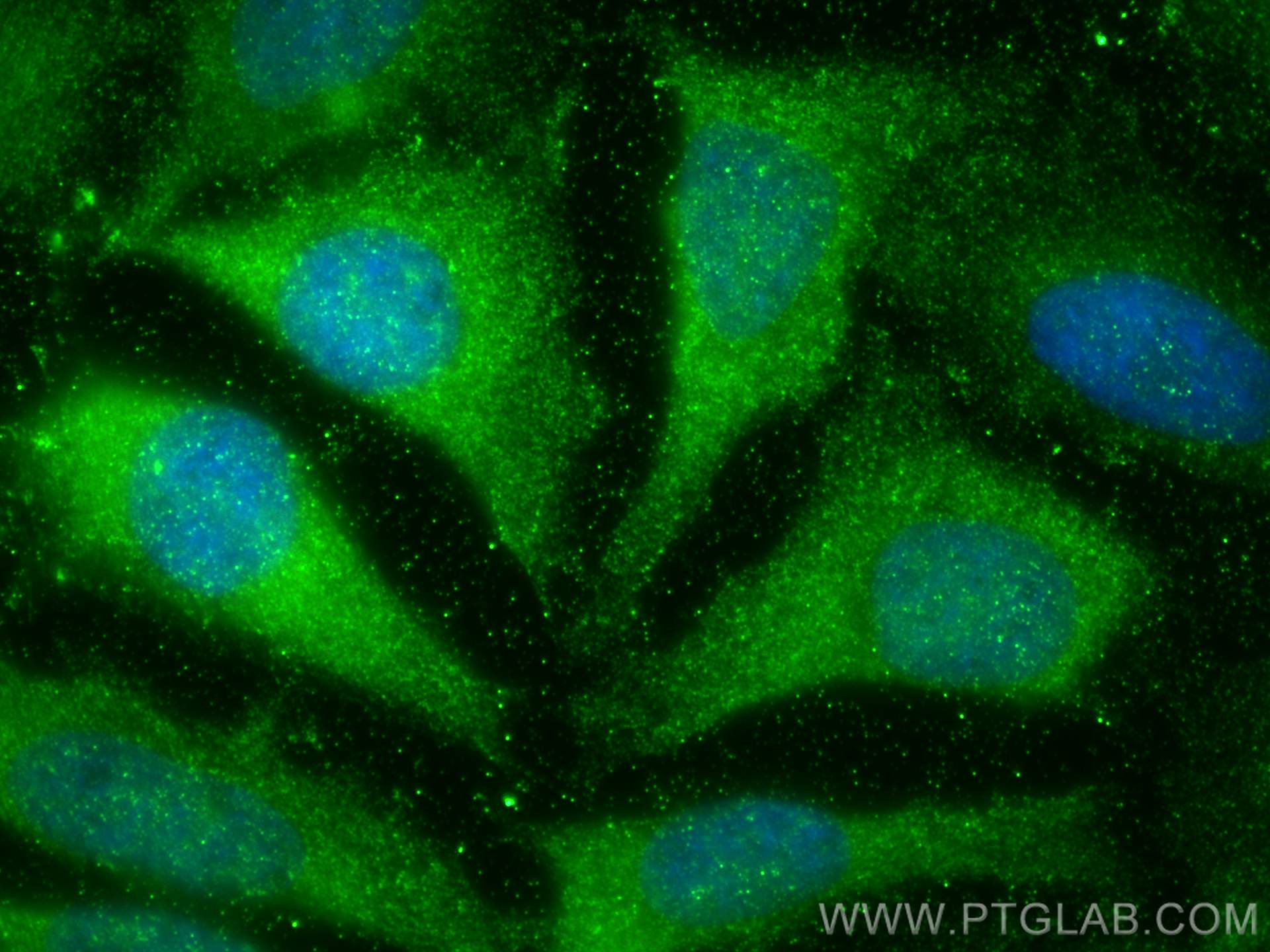 IF Staining of HeLa using 80457-1-RR