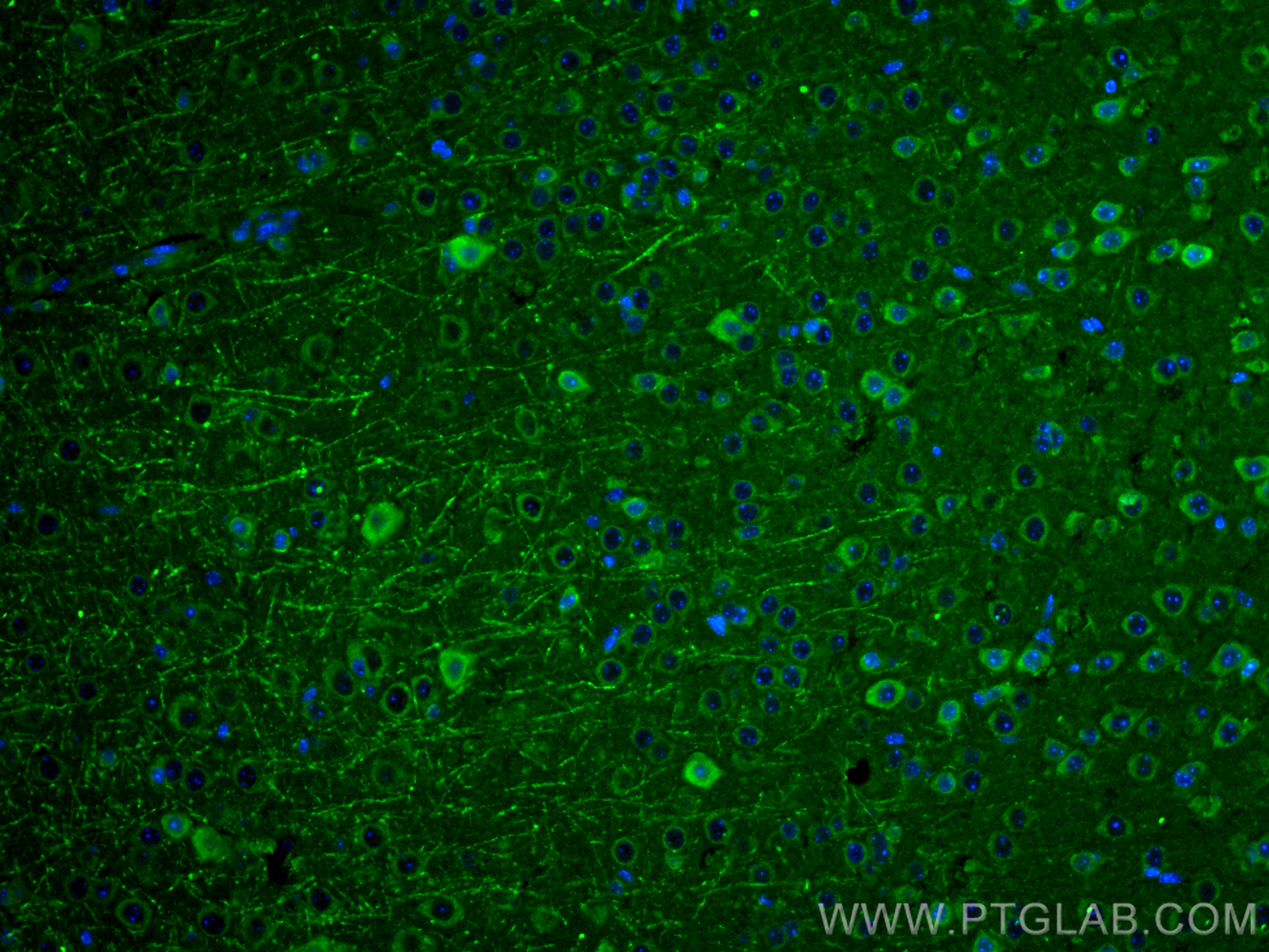 IF Staining of mouse brain using 16200-1-AP