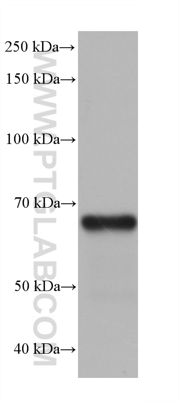 WB analysis of pig adrenal gland using 68567-1-Ig