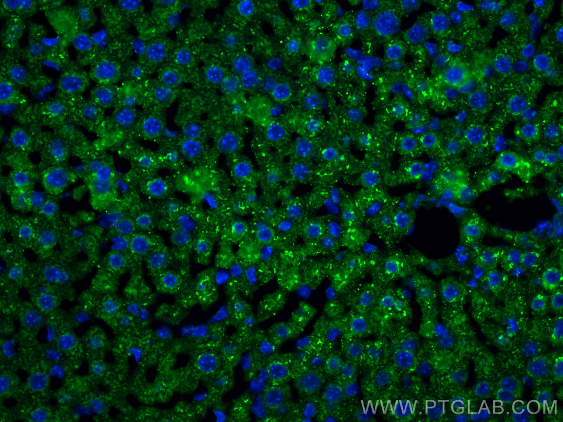 IF Staining of mouse liver using 16475-1-AP