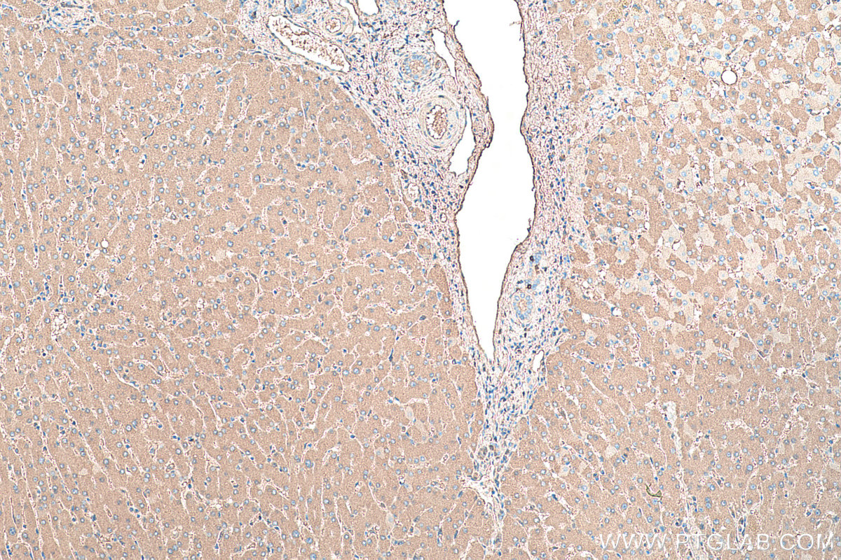 IHC staining of human liver using 66051-1-Ig