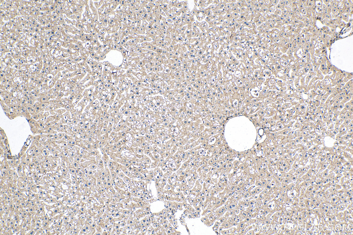 IHC staining of mouse liver using 21972-1-AP