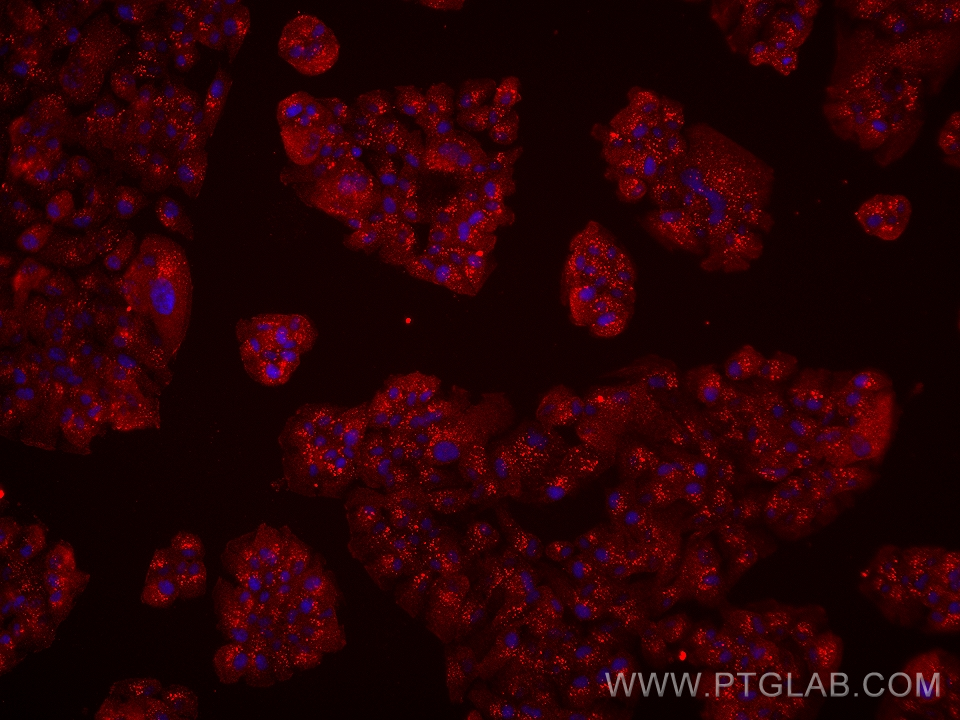 IF Staining of hTERT-RPE1 using 67768-1-Ig (same clone as 67768-1-PBS)